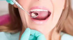 Most common causes of cavities in the teeth — and how to prevent them